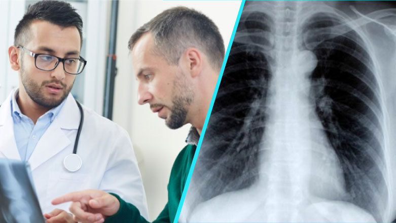 Medic: Riscul de cancer pulmonar este mai mare la barbati | Factori de risc si preventie