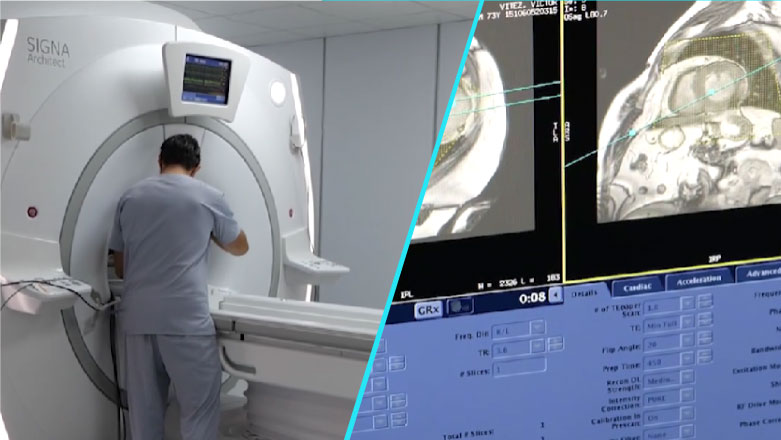 RMN-ul cardiac, „standardul de aur” pentru diagnosticarea si monitorizarea afectiunilor inimii