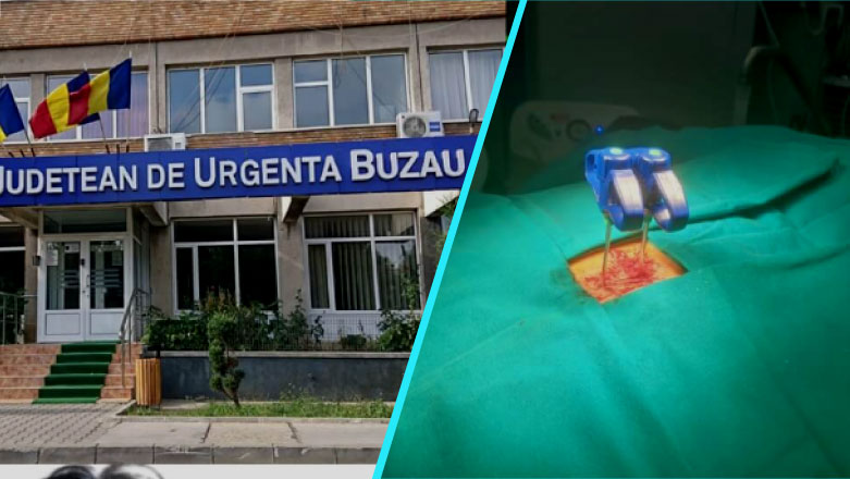 Premiera la Buzau: Interventie neurochirurgicala de vertebroplastie percutana